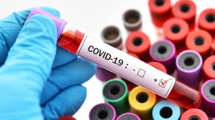 Bu, edilərsə, koronavirus YOX OLACAQ - Azərbaycanlı həkim AÇIQLADI