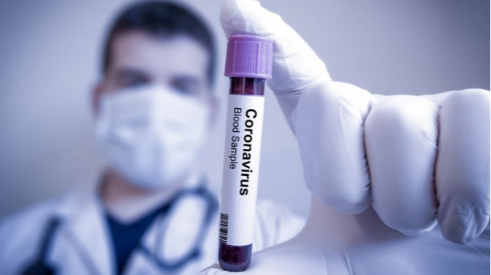 Azərbaycanda indiyədək 885 279 koronavirus testi aparılıb