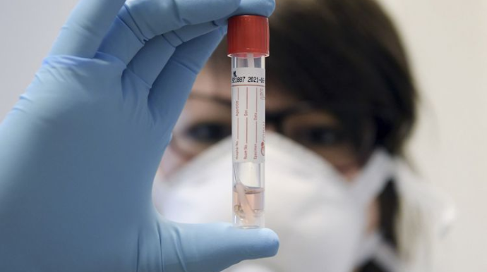 Azərbaycanda indiyədək 980978 koronavirus testi aparılıb