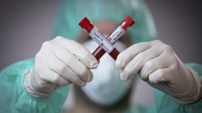 ABŞ-da son sutkada koronavirusdan 693 nəfər ölüb