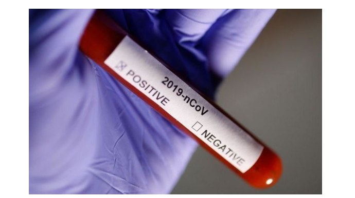 Azərbaycanda daha iki nəfər koronavirusdan öldü: 509 yeni yoluxma   - FOTO