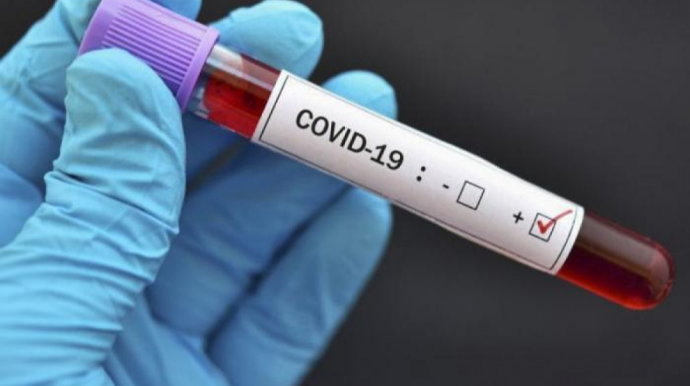 Azərbaycanda daha 585 nəfər COVID-19-a yoluxub, 1 nəfər ölüb