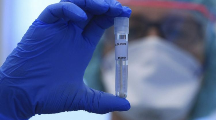 İranda COVID-19-a yoluxanların sayı 250 mini keçib