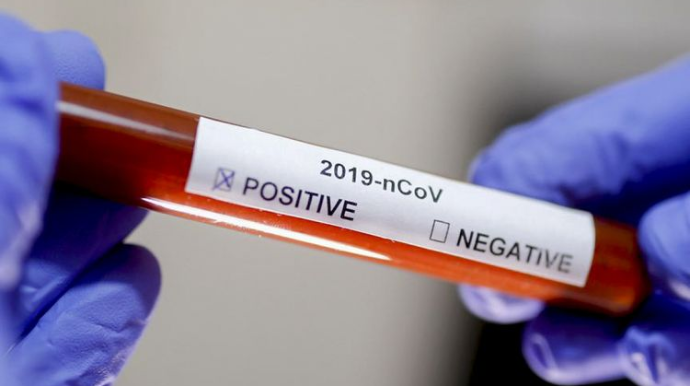 İrandan koronavirusdan ölənlərin sayı 10239 nəfərə çatıb