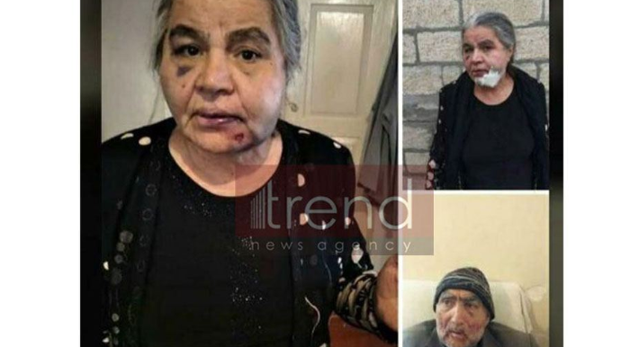 Şamaxıda evə girən oğru yaşlı ər-arvadı amansızcasına döydü - FOTO