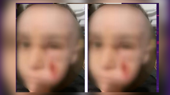 Bakıda bağçada uşaq ağır xəsarət aldı - Təcili yardım çağırılmadı - VİDEO 