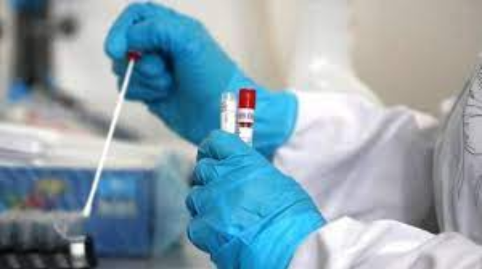 Azərbaycanda COVID-19 ilə bağlı statistik hesabat həftədə bir dəfə veriləcək