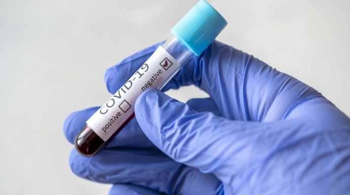 Azərbaycanda daha 169 nəfər koronavirusa yoluxub, ölən yoxdur - FOTO