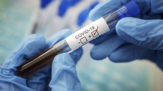 Azərbaycanda indiyədək 1728577 koronavirus testi  aparılıb