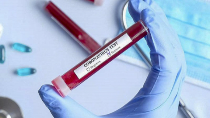 Çində koronavirusa günlük REKORD YOLUXMA - 37 milyon nəfər   