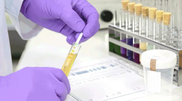 İşə qəbul zamanı narkoloji test tələb edilə bilər  - VİDEO