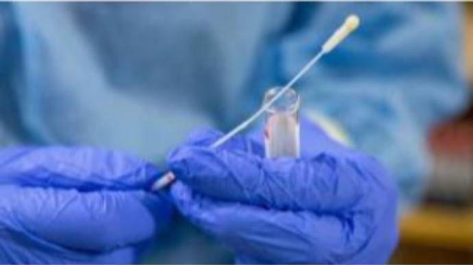 “COVID-19”u 10 dəqiqəyə aşkarlayan ekspress test hazırlanıb