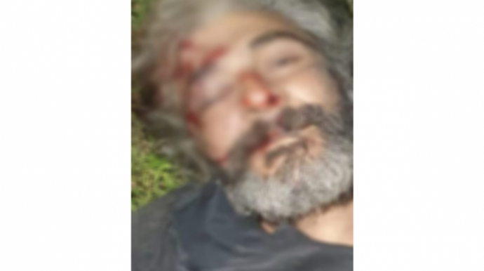 Polis avtomobilin vurub öldürdüyü şəxsin kimliyini araşdırır - FOTO 