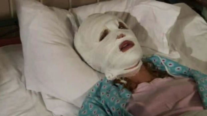 В Азербайджане свекор облил невестку химикатом и поджег  - ФОТО - ВИДЕО