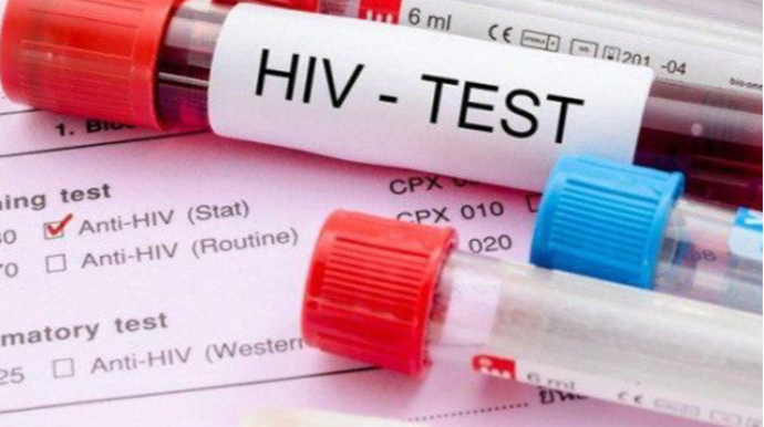 Azərbaycanda İİV-ə yoluxanların sayı açıqlandı 