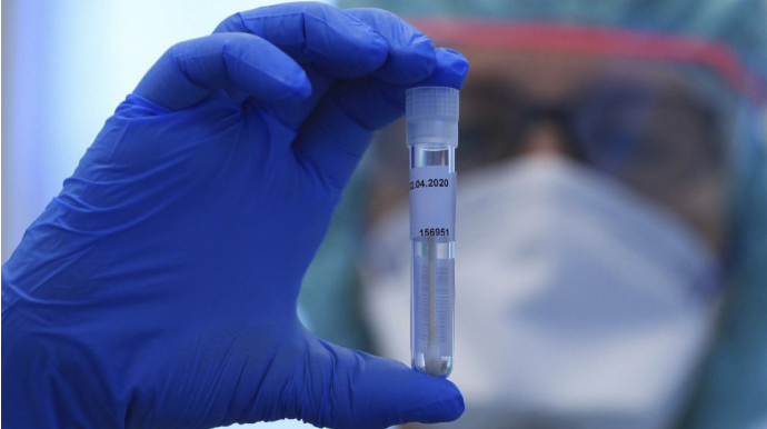 Azərbaycanda son sutkada 104 nəfər COVID-19-a yoluxub, 39 nəfər sağalıb