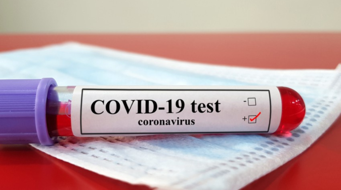 В Азербайджане 84 новых случая заражения коронавирусом