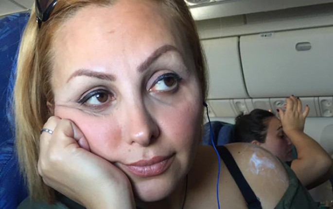 ANS-in əməkdaşının üstünə qaynar su töküldü - AZAL-ın təyyarəsində