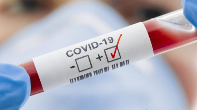 Ən çox yoluxanlar 30-39 yaşlı  şəxslərdir