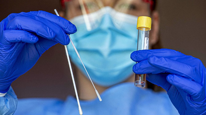 Ermənistanda koronavirusdan ölənlərin sayı 711-ə yüksəldi