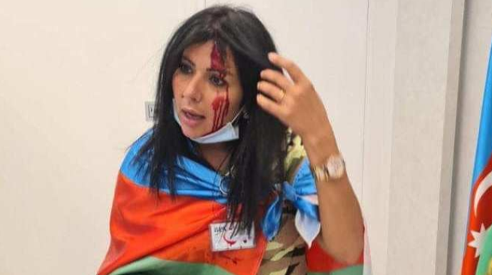 Ermənilər Hollandiyada azərbaycanlı jurnalistə xəsarət yetirdi – FOTO 