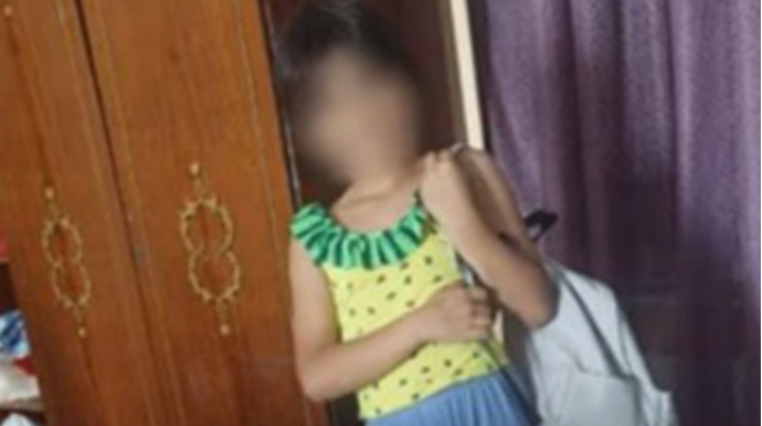 Ana azyaşlı qızının bədənində siqaret söndürüb? - VİDEO