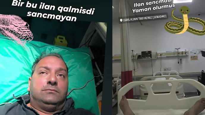 Elnur Kərimovu ilan sancdı - FOTO