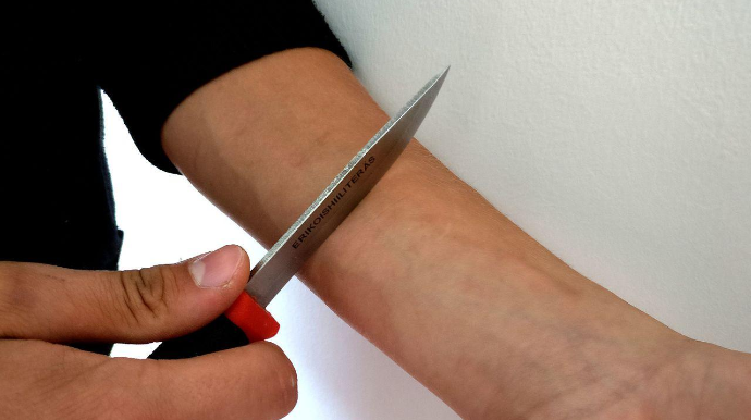 Bakıda 33 yaşlı şəxs qolunu doğradı