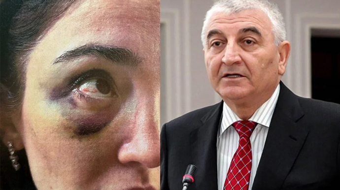 Keçmiş gəlinindən Məzahir Pənahova İTTİHAM: "Ona nüfuz önəmli deyil, zinət əşyalarımı qaytarmırlar"