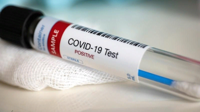 Azərbaycanda koronavirusa 129 yeni yoluxma faktı qeydə alınıb