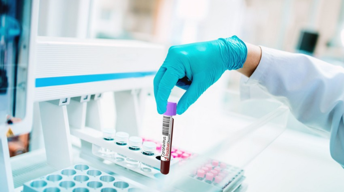 ÜST: Hazırda koronavirusun müalicəsi üçün dərman yoxdur