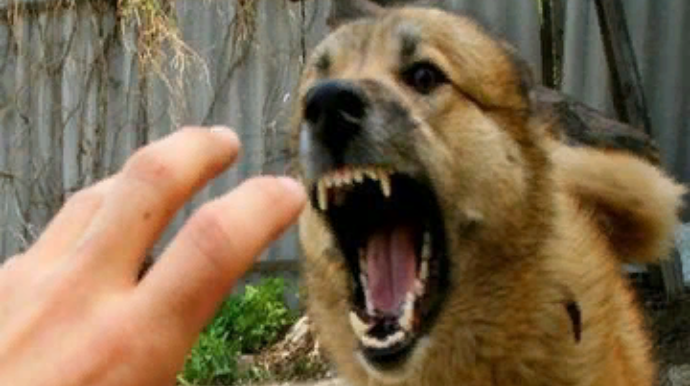 Bakıda sahibsiz it 9 yaşlı uşağın dodağından dişlədi