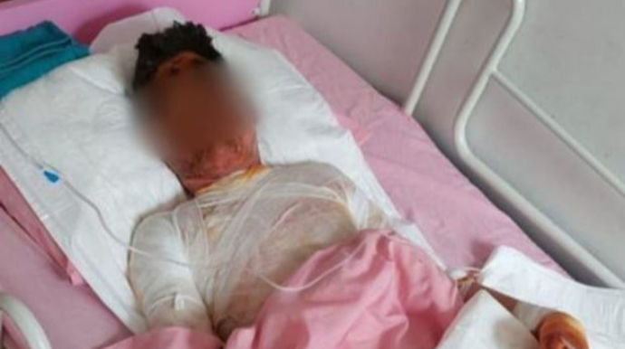 İki azyaşlını xilas etmək istəyərkən qır qazanında yanan Sənanın anası: “Aptekə 240 manat borcumuz var” - FOTO 