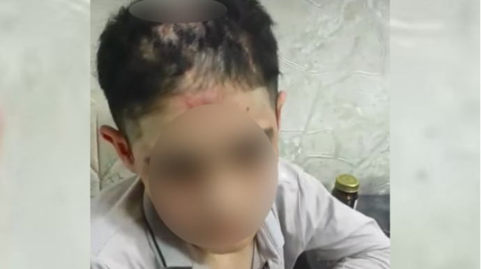 14 yaşlı yeniyetmənin işgəncələrə məruz qalması ilə bağlı ŞOK TƏFƏRRÜAT  - VİDEO