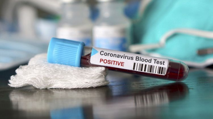 Braziliyada koronavirusdan ölənlərin sayı 23 mini ötüb