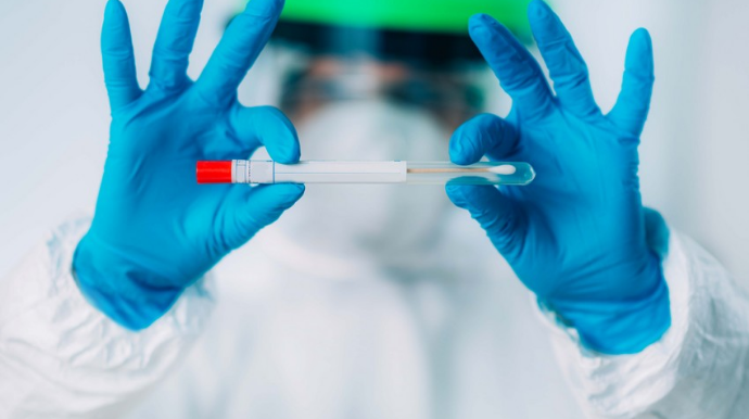 Azərbaycanda daha 832 nəfər koronavirusa yoluxub, 21 nəfər ölüb 