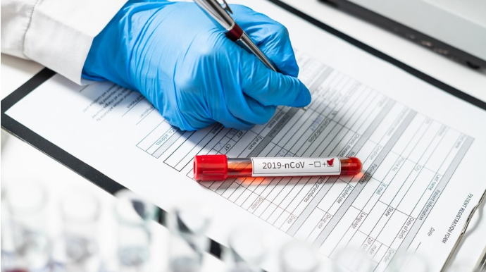 Azərbaycanda son sutkada 96 nəfər koronavirusa yoluxub, 2 nəfər ölüb 