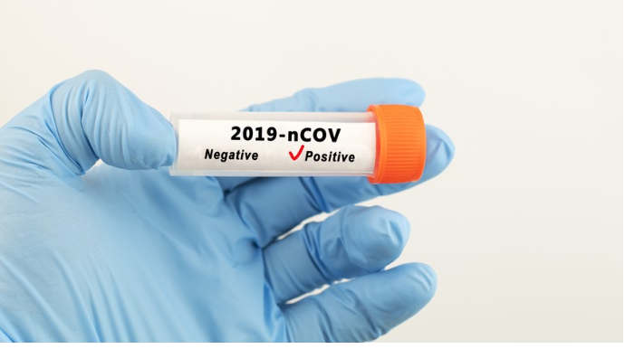 Azərbaycanda 1 227 yeni yoluxma  faktı qeydə alındı