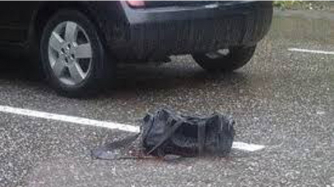 Bakıda qadını avtomobil vurub