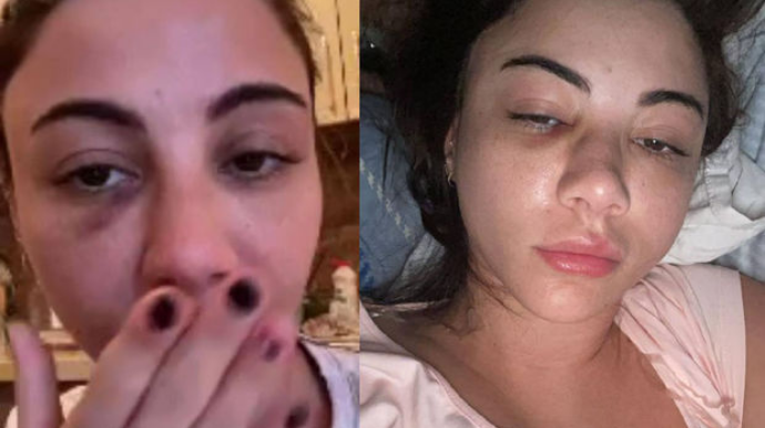 Aysel Əlizadə ağır qəzaya düşdü - FOTO