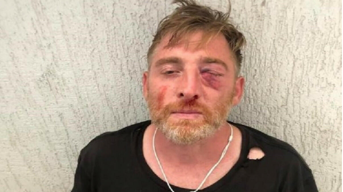 Aksiyada döyülən "Pirveli TV"nin əməkdaşı öldü 