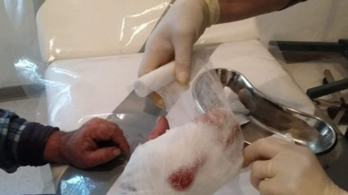 Sürü halında gəzən itlər hər tərəfə qorxu saçır  - 61 yaşlı şəxsə küçə itləri hücum etdi, ona ...   - VİDEO