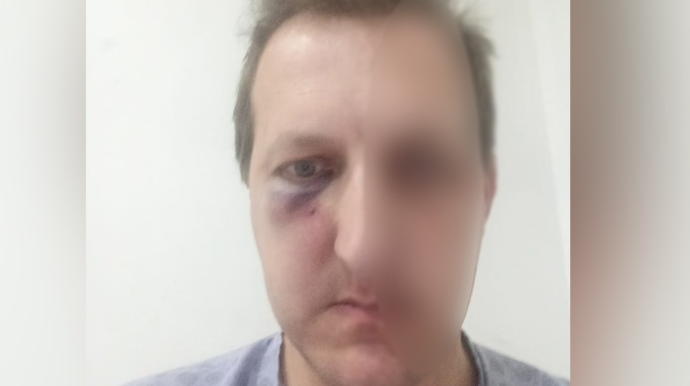 Bakıda Xalq artistinin oğlunun döyülməsi ilə bağlı bir nəfər saxlanıldı   - YENİLƏNİB