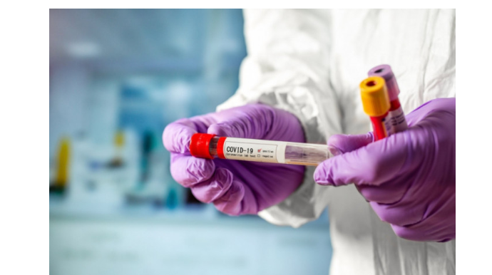 Azərbaycanda daha 17 nəfər koronavirusdan vəfat edib - FOTO 