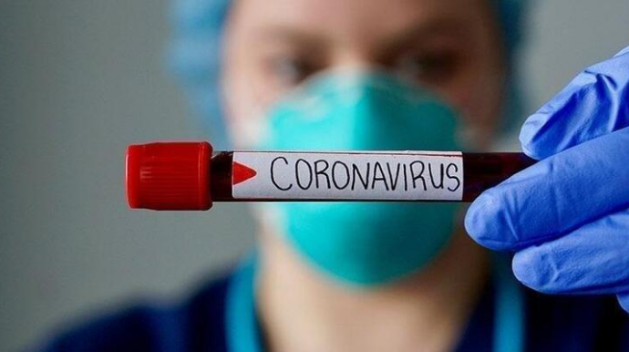 ÜST:  Dünyada yenidən koronavirusa rekord yoluxma qeydə alınıb