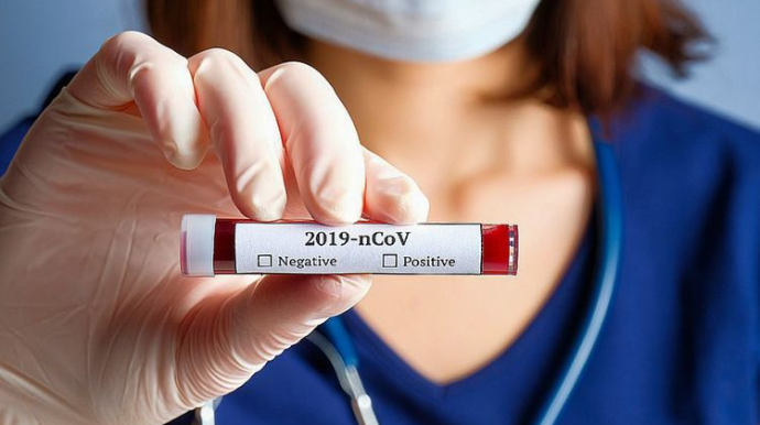 ABŞ-da koronavirusdan ölənlərin sayı 114 mini ötüb