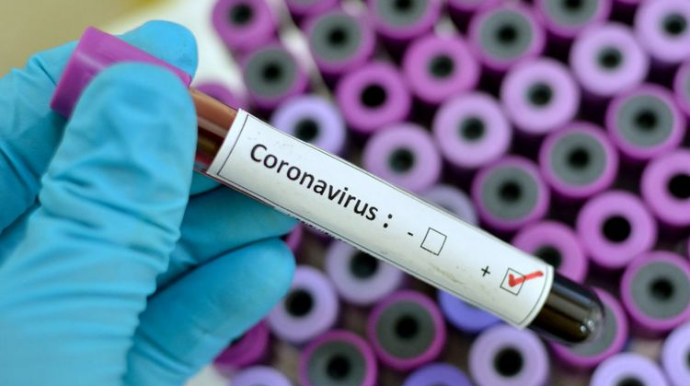 Britaniyada son sutkada koronavirusdan 204 nəfər ölüb
