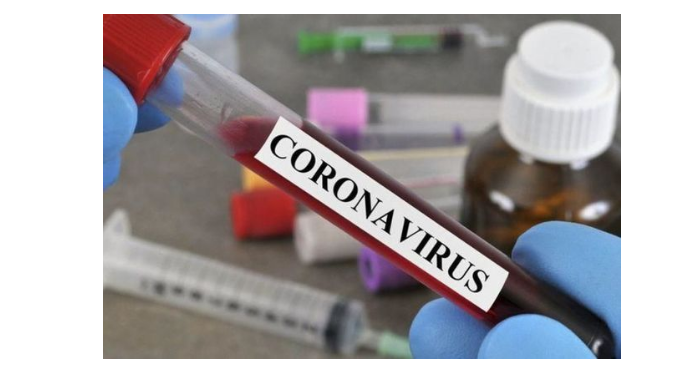 Dünyada koronavirusa yoluxanların sayı 43 milyonu keçdi - STATİSTİKA 