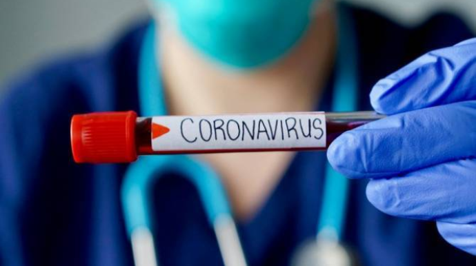 Toy mərasiminə qatılan 52 nəfər koronavirusa tutuldu 