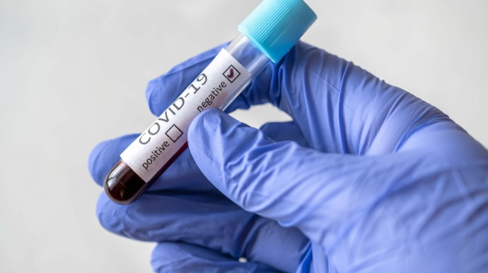 Yoluxanların sayı 1000-ə çatır